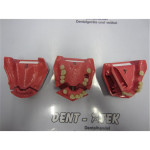 Go Dent Modelle - Schaumodelle - Patientenaufklärung - Zahnmedizin