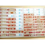 Zähne - Kunststoffzähne - Polystar Lux - Articron