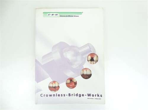 Anwender-Handbuch CBW Crownless Bridge Works Deutsch English